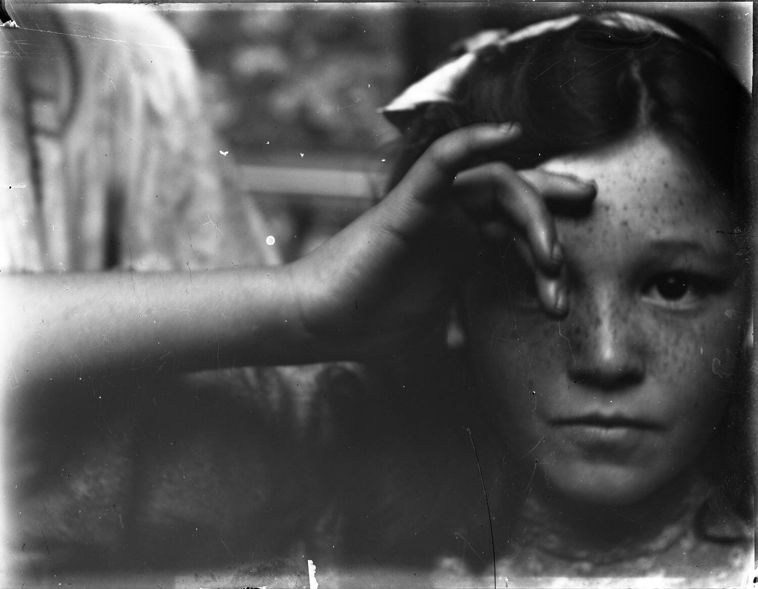 A black and white photo of a girl's head. She has freckles and dark hair. A second person's hand is in front of her right eye.